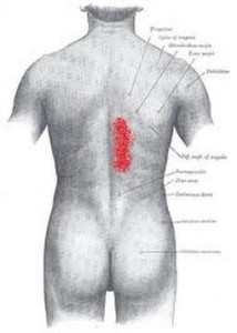 back-muscle-pain
